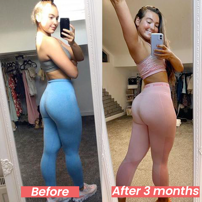 Protone™ – Effortlessly Tone Your Glutes from the Comfort of Home (Enhanced Version)